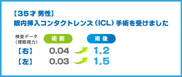 ICL体験談