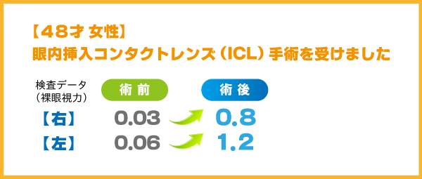 ICL体験談2